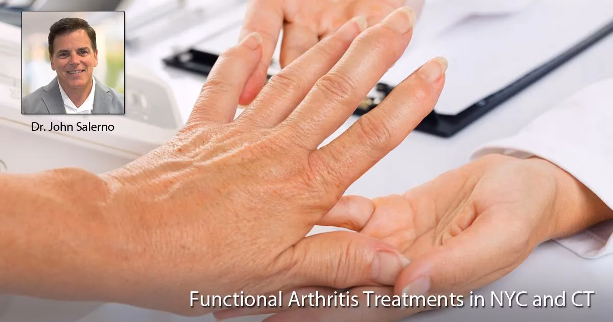 Welcher Arzt ist für Arthrose zuständig?