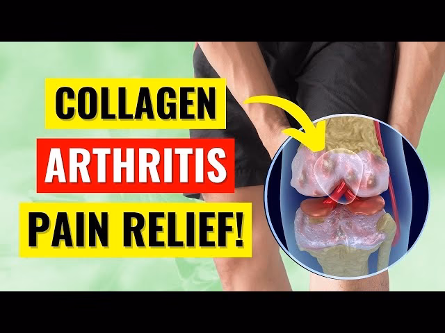 Can collagen help treat arthritis?