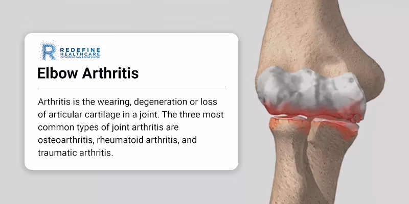 What types of arthritis can affect the elbow?