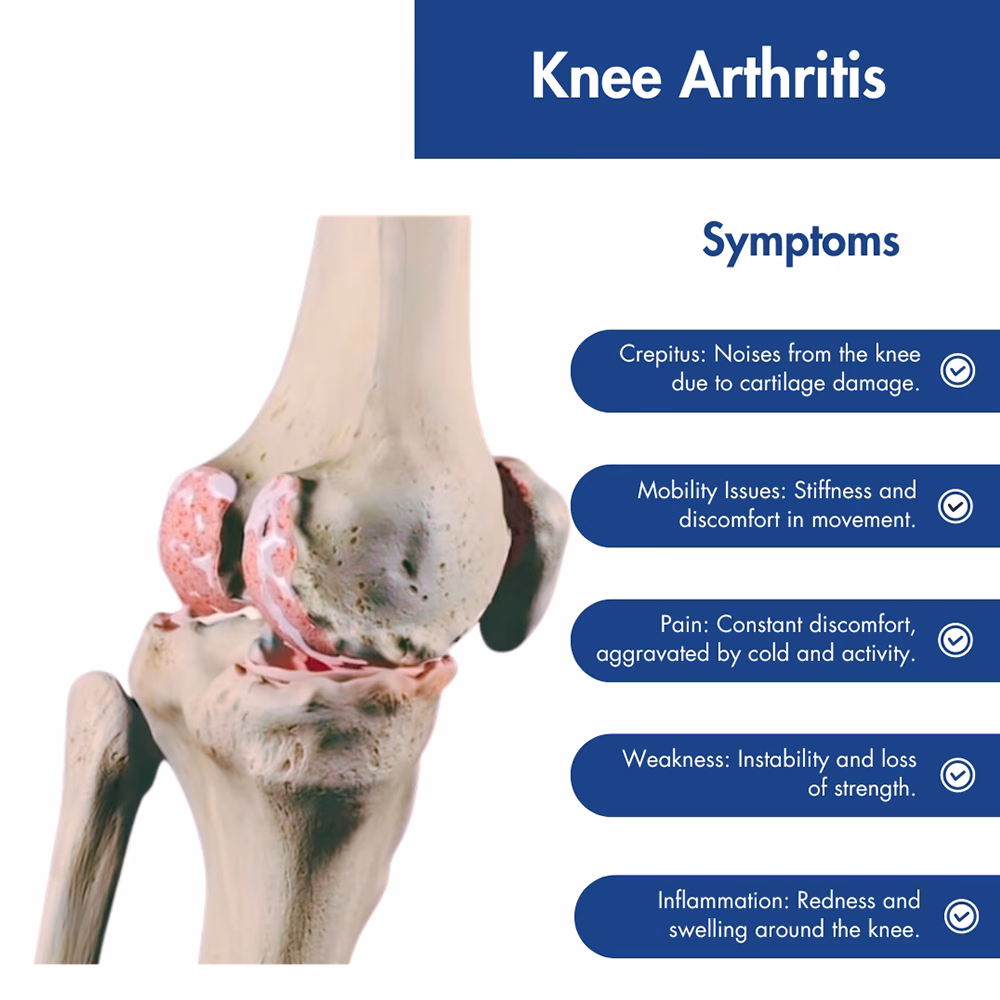 Is knee pain a symptom of arthritis?
