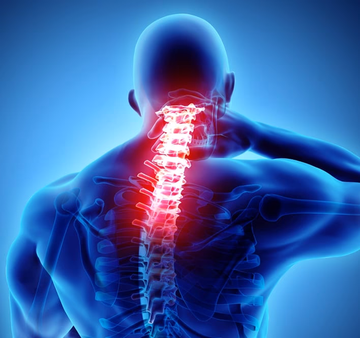 Can arthritis cause neck pain?