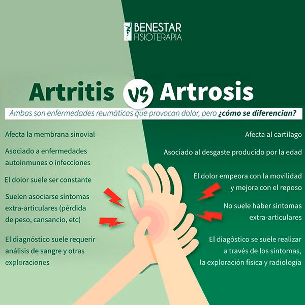 ¿Qué es una artritis?
