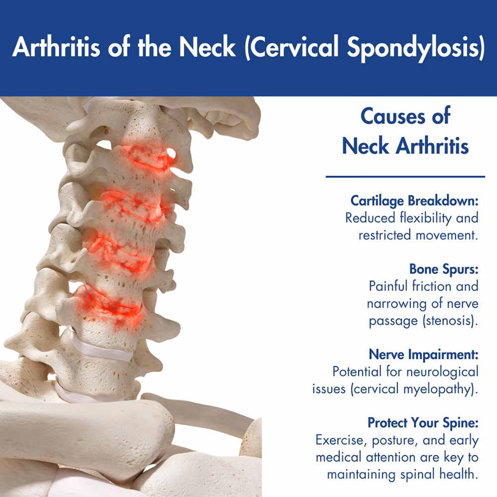 Can arthritis cause neck pain?