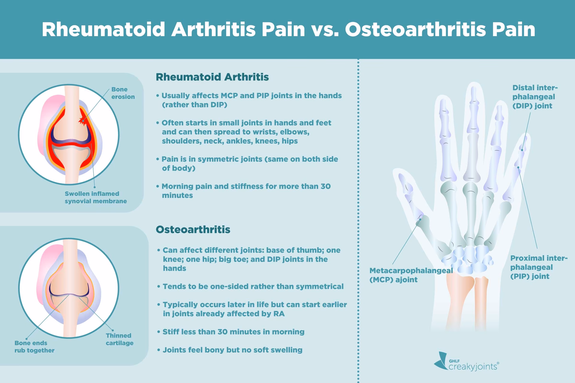 What is the difference between osteoarthritis and autoimmune arthritis?