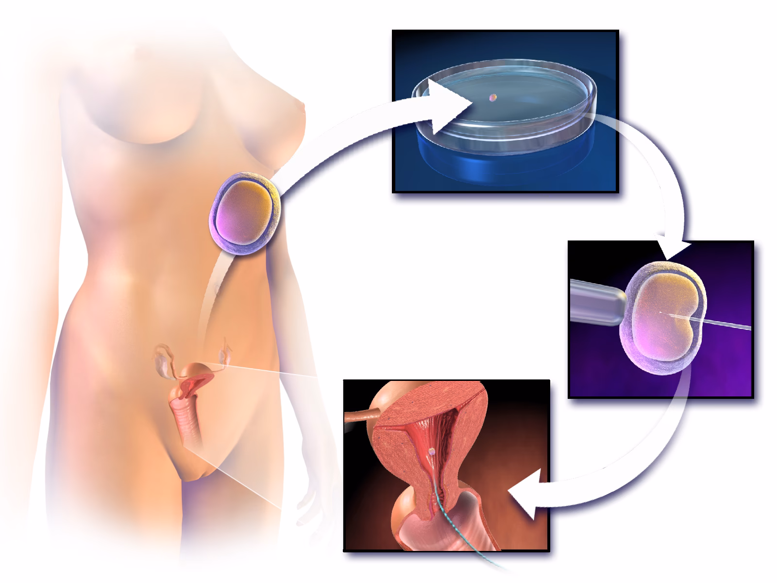 How do assisted reproductive technologies work?