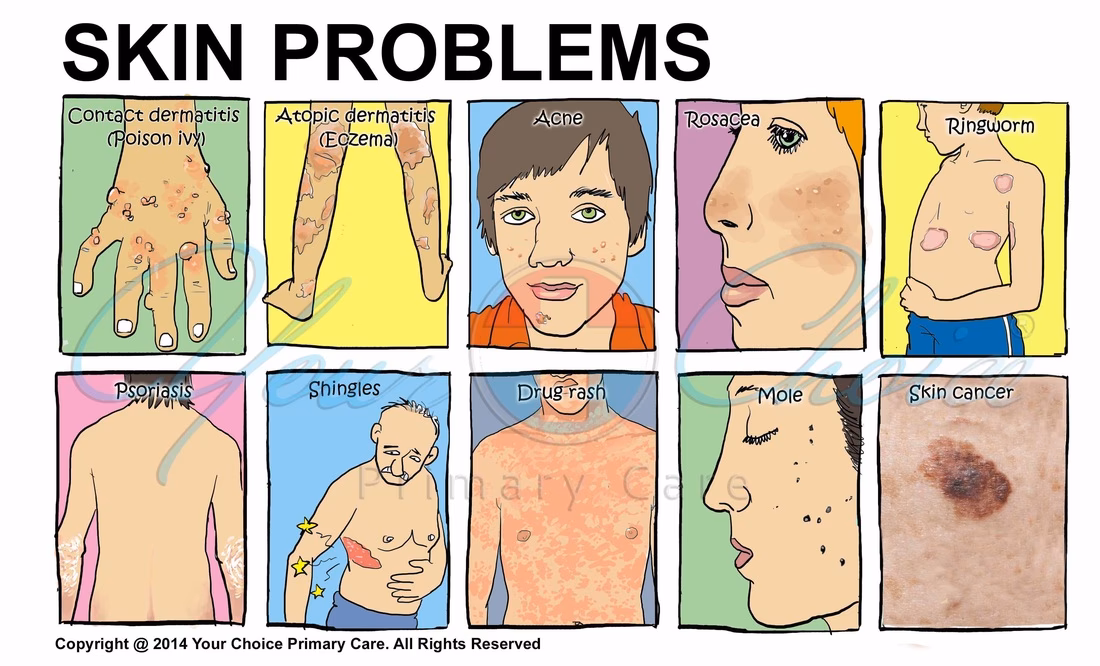 Can post-traumatic stress disorder cause skin problems?