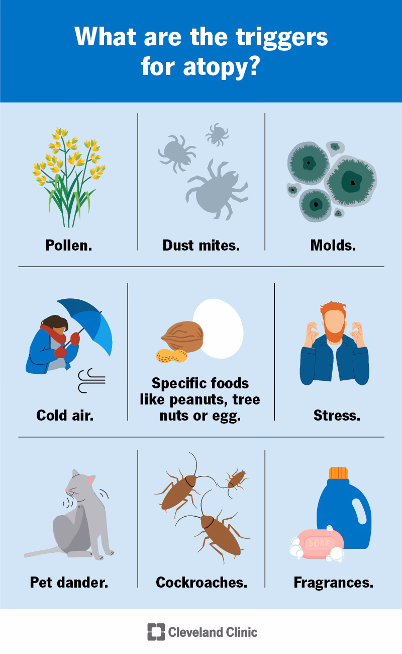 Is atopy a symptom of a drug allergy?