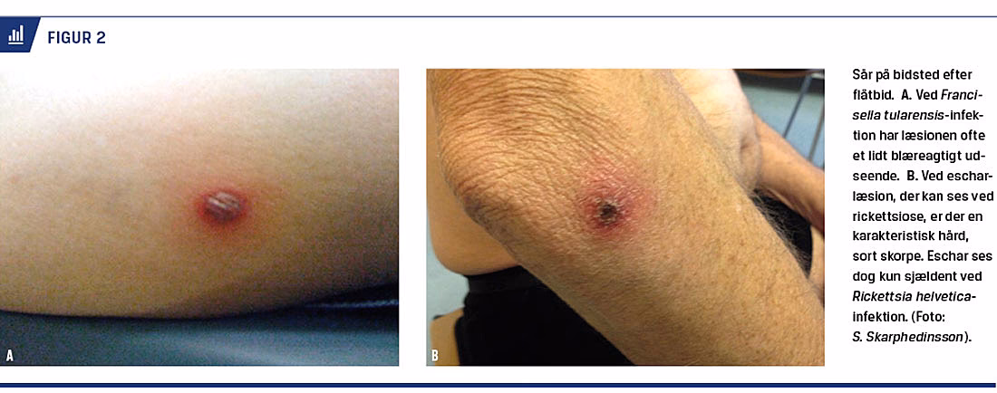 Was ist die besondere Krankheitsvariante von BVD?