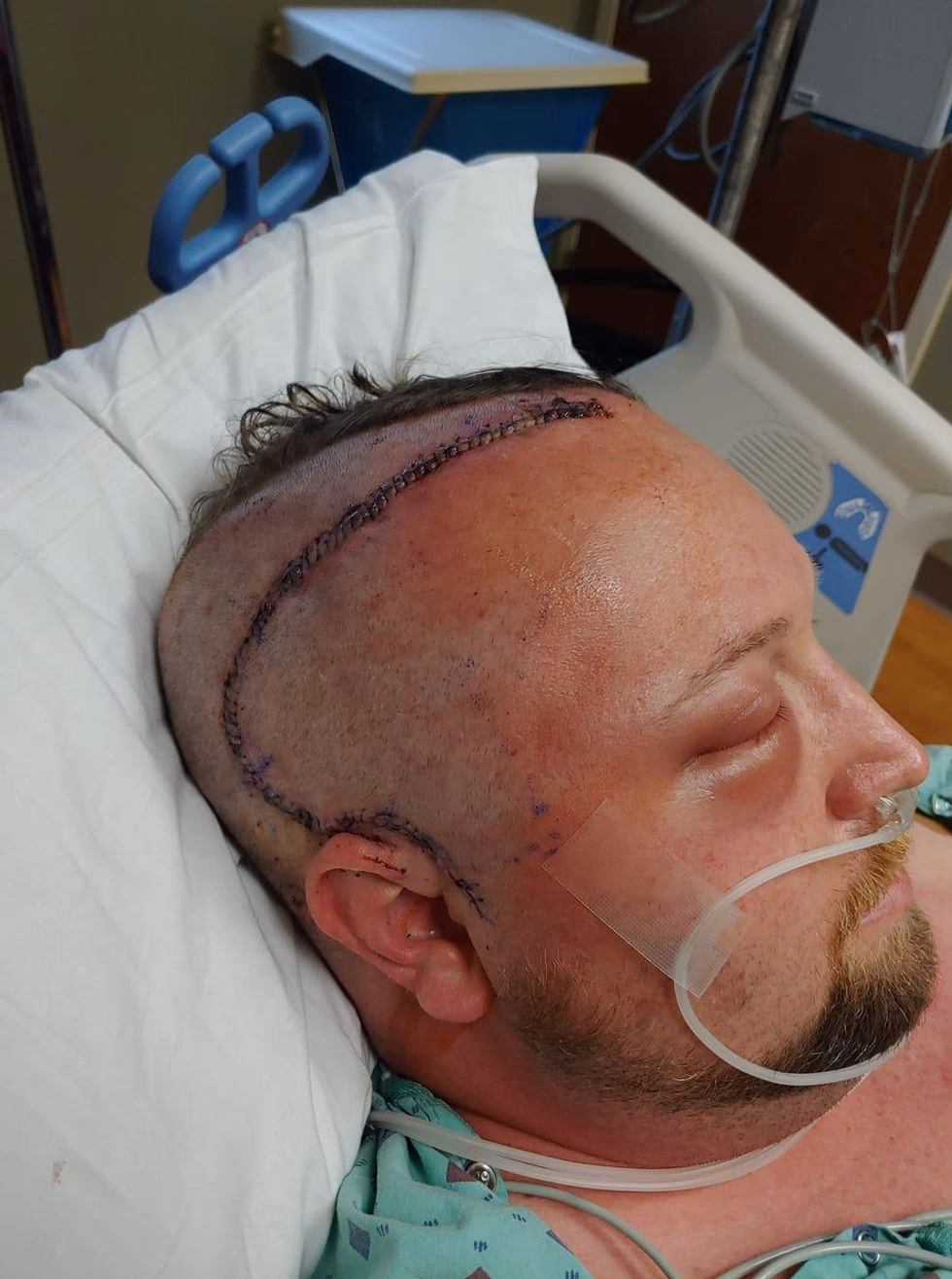 How does a craniotomy work?