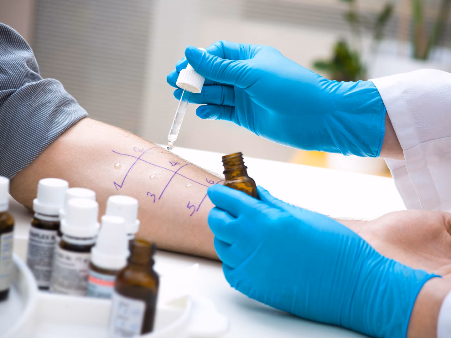 What is food allergy testing?