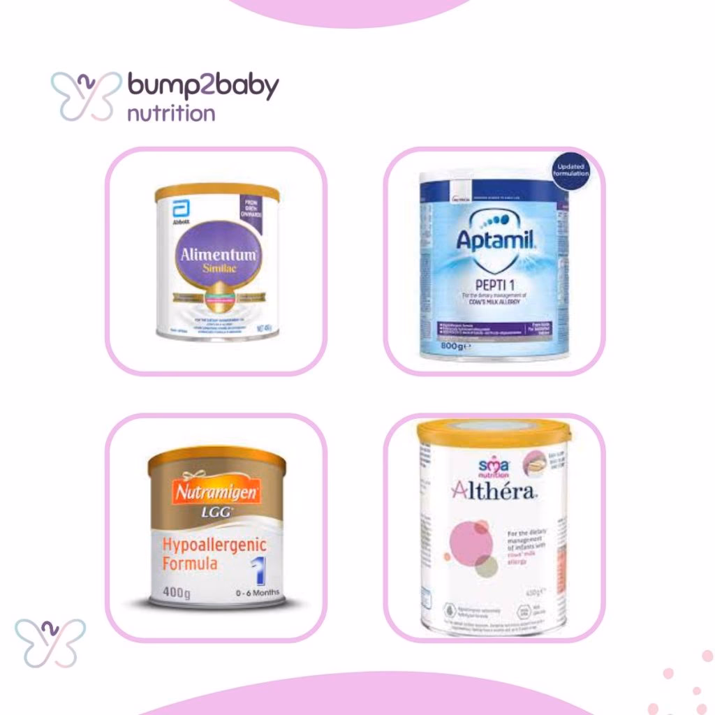 Can a baby eat a milk formula if he is allergic?