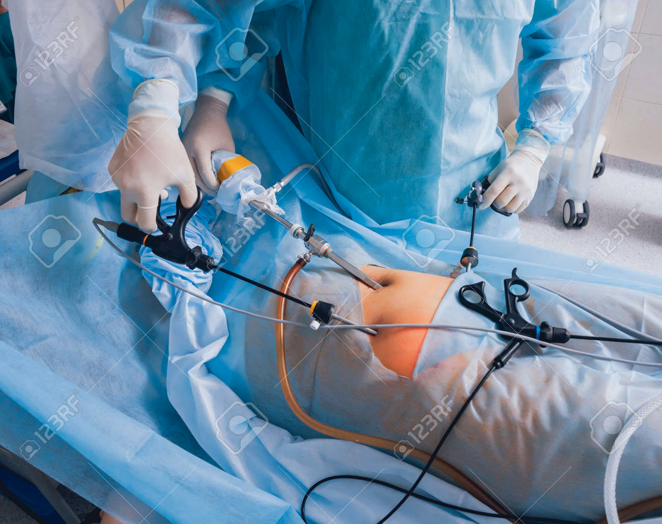 Which hospital is best for laparoscopic surgery?