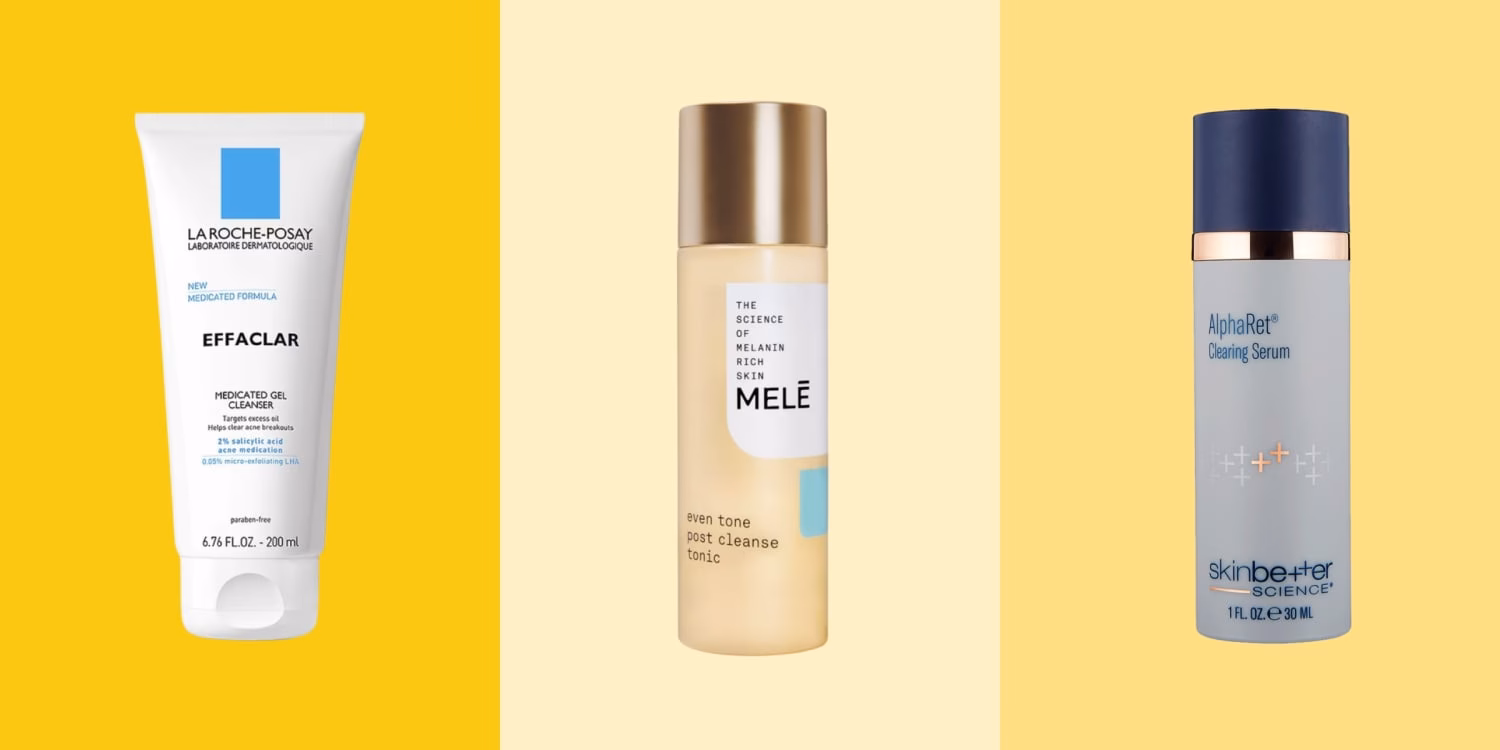 How do I get rid of Blackheads?