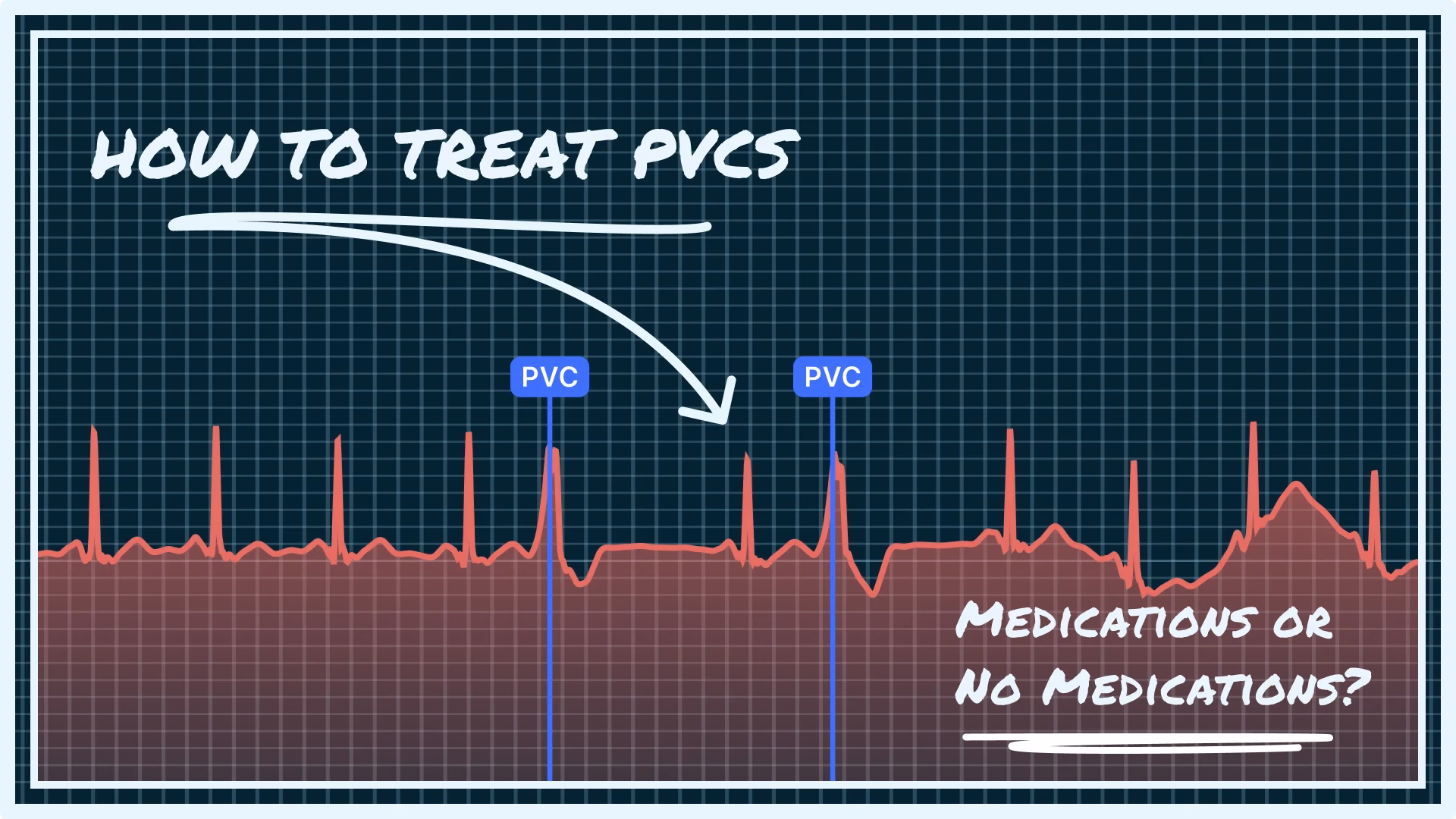 What are the treatment options for PVC?