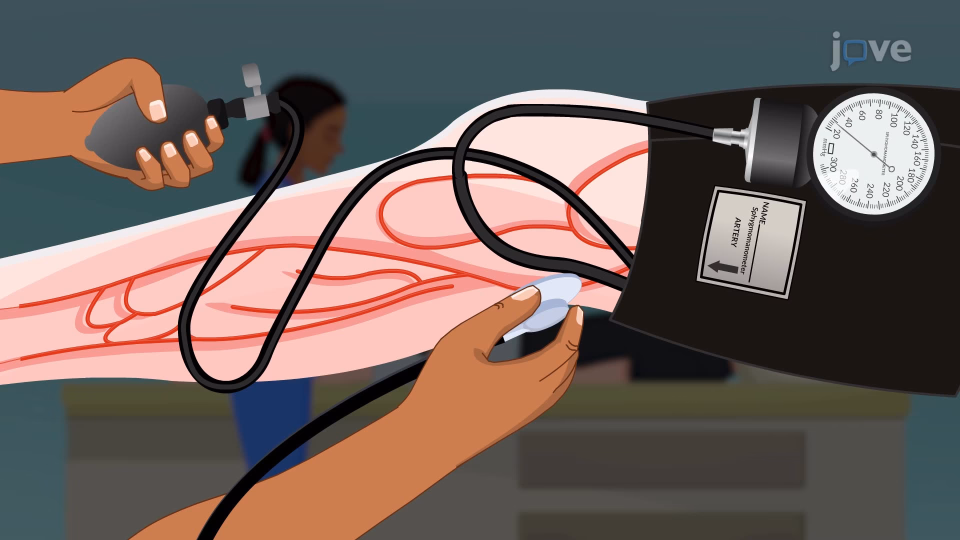 How high is systolic blood pressure in the legs?