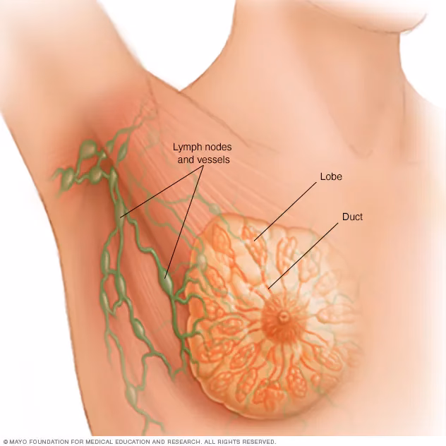 What are the treatment options for breast cancer?