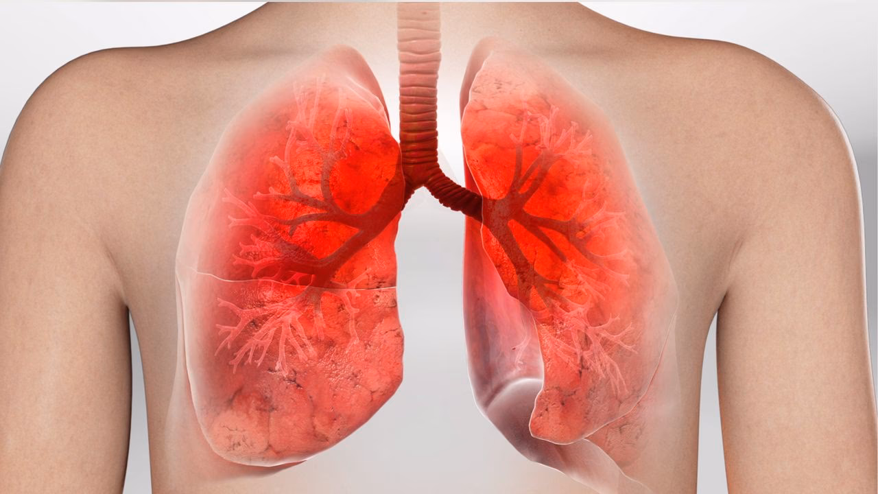 Wie lange dauert eine Bronchitis bei Kindern?