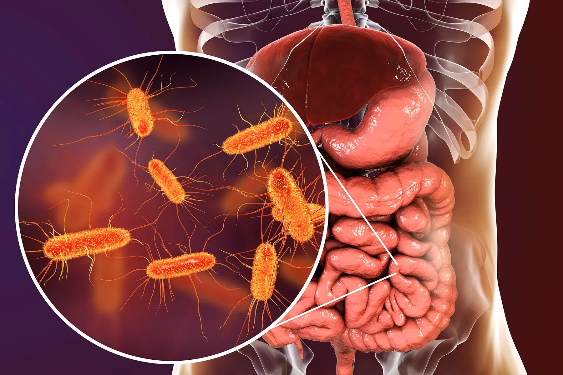 What is E coli in lungs?