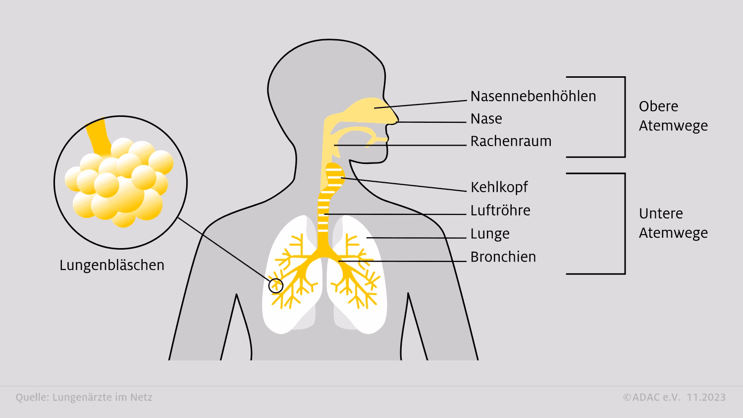 Was ist der Unterschied zwischen einer Pneumonie und einer Bronchitis?