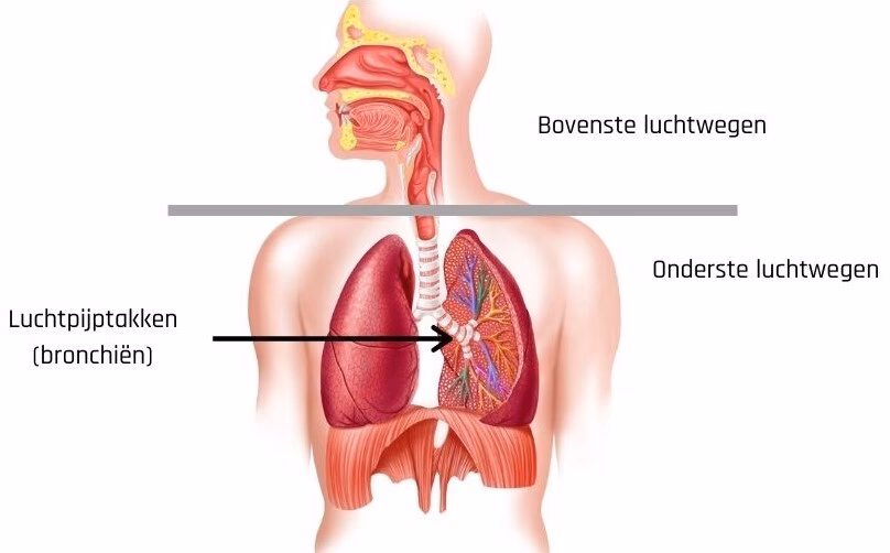 Is bronchitis genezen?
