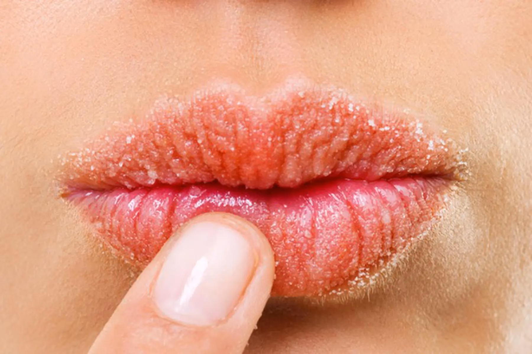 What causes lip allergies?