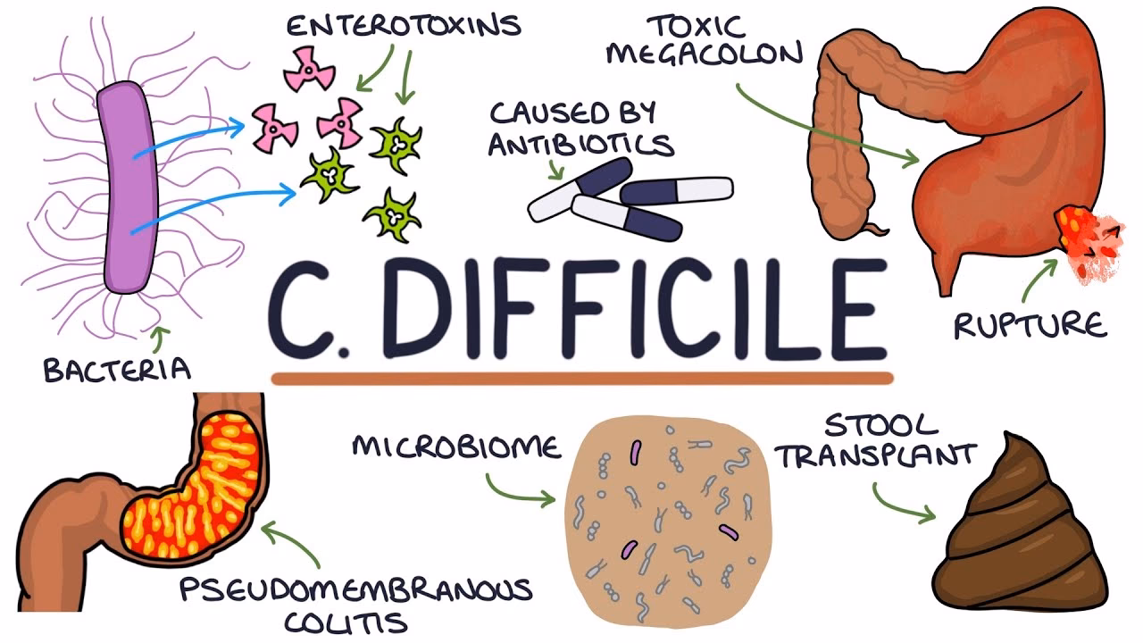 What do you know about Clostridioides difficile?