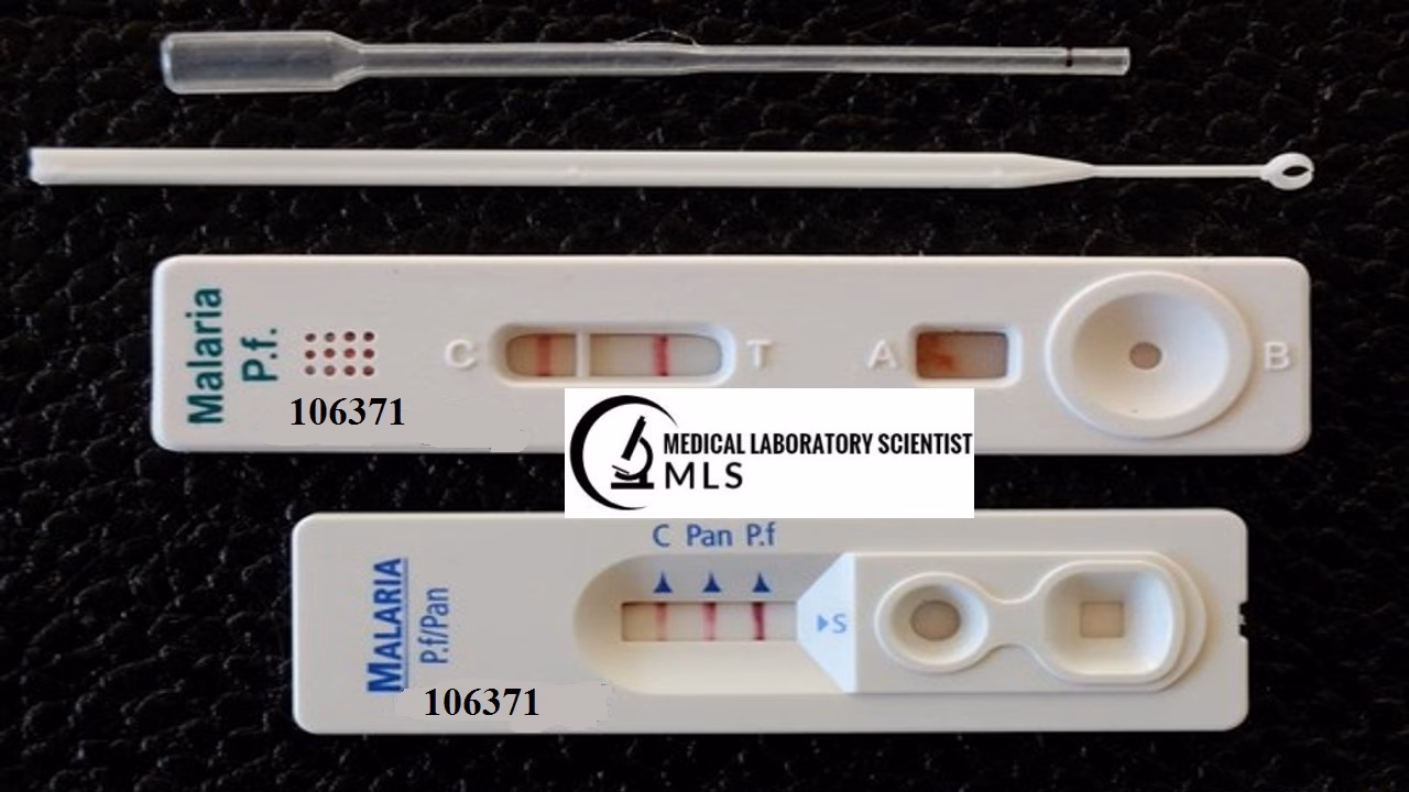 How to detect a malaria antigen in a blood test?