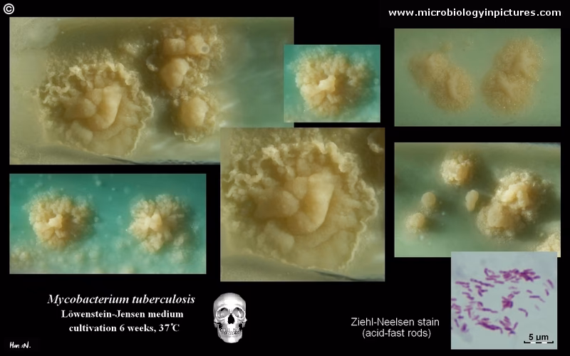 What color is Mycobacterium tuberculosis?