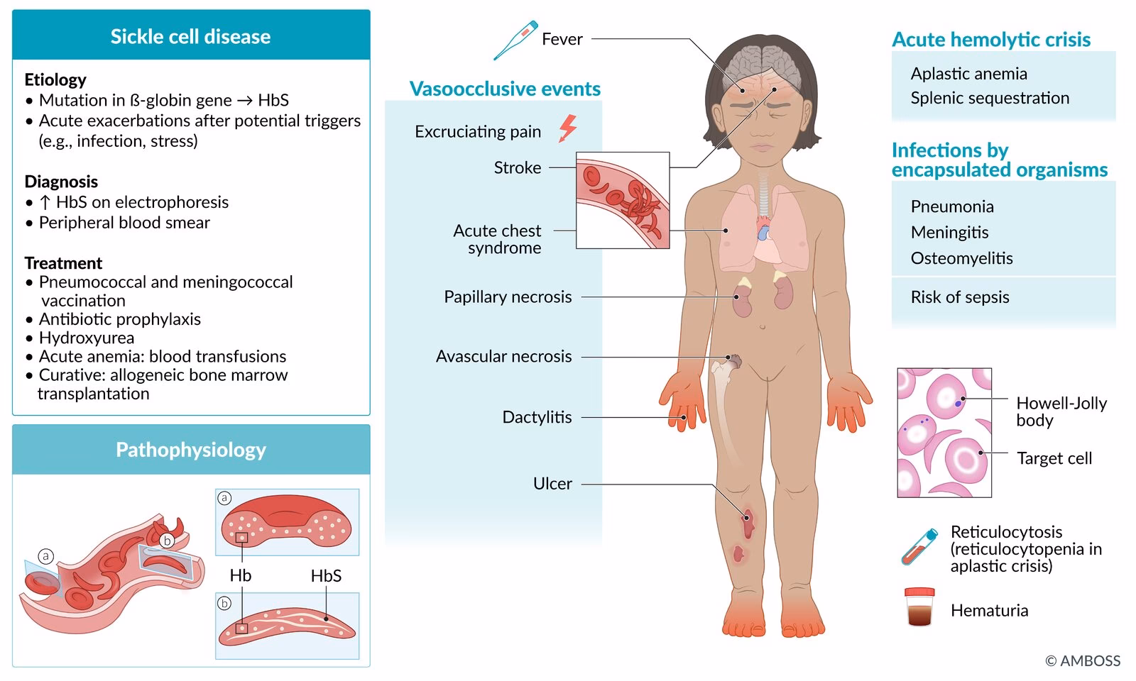 Do you have sickle cell anemia?