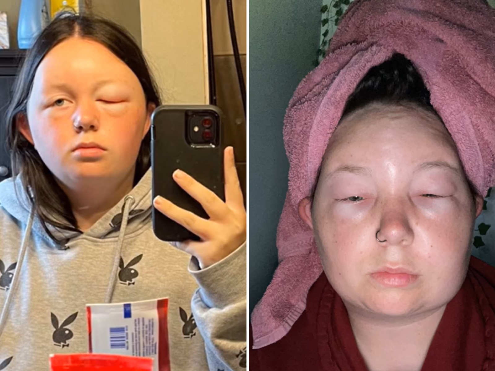 Are You allergic to hair dye?