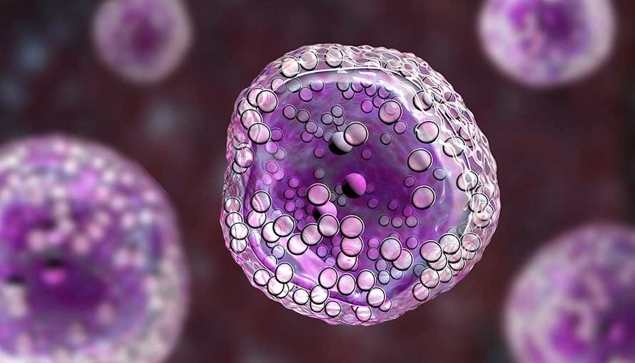 What is the prognosis of B-cell lymphoma?