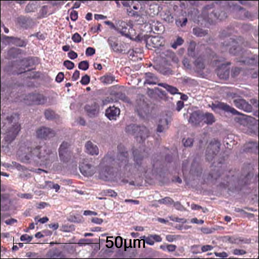 What are hematoxylin and eosin stains?