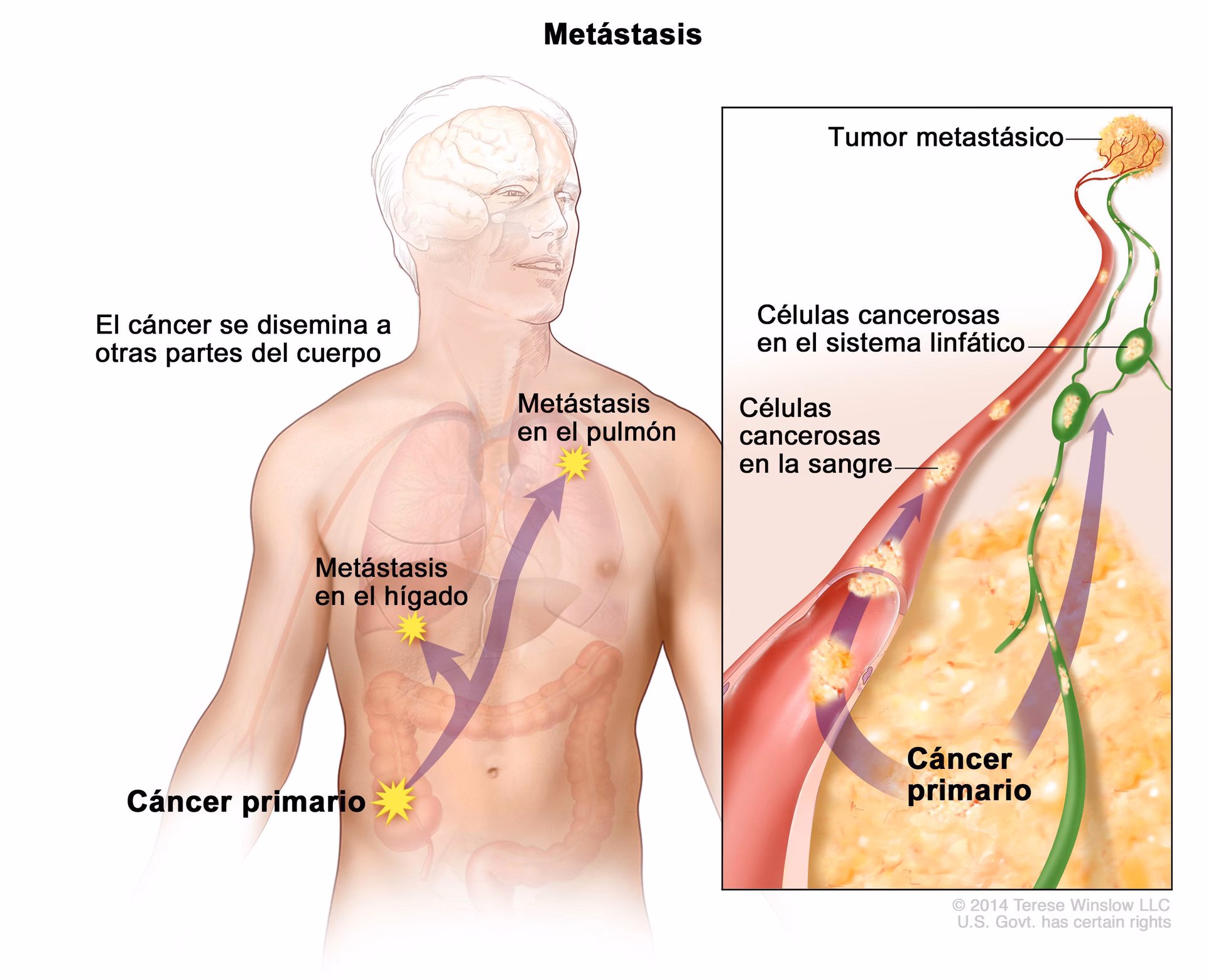 ¿Qué es el cáncer y cómo se cura?