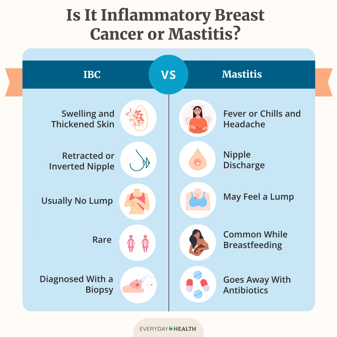 Can allergic history cause cancer?
