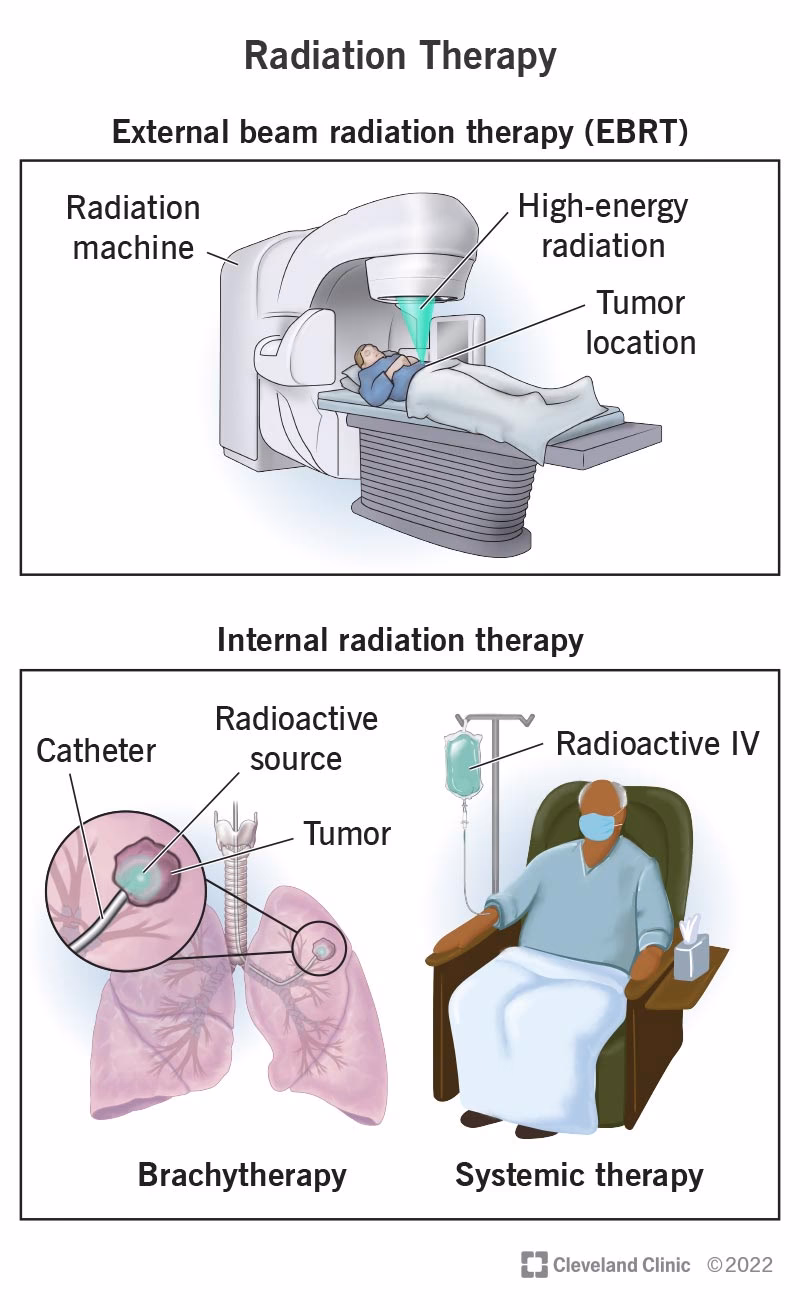 How is cancer treated?