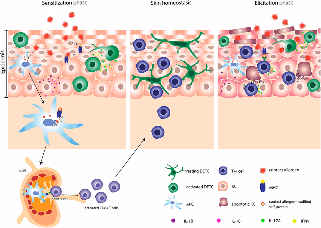 Which type of T lymphocyte responds to allergens?