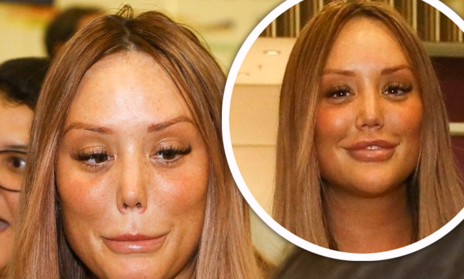 Why did Charlotte Crosby change her mouth size?