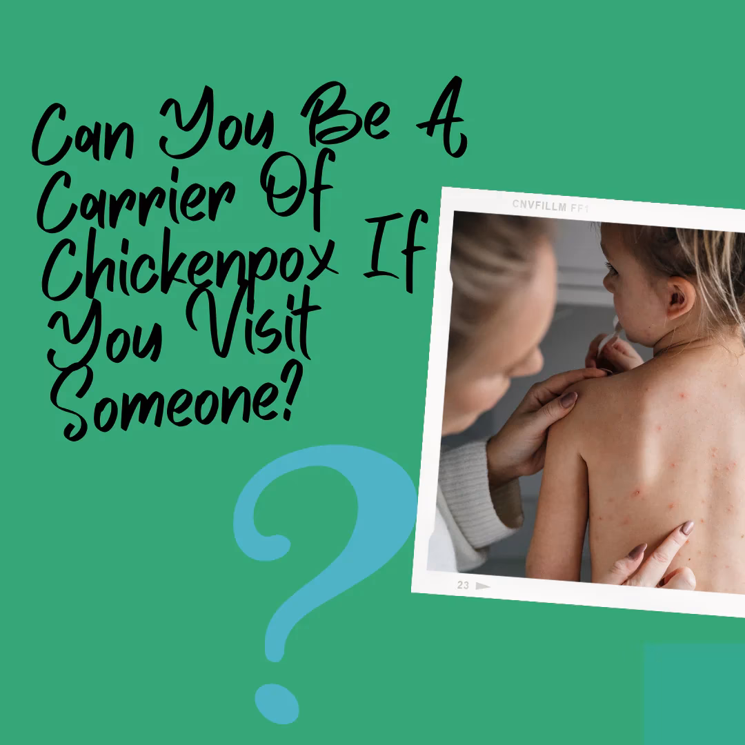 Can you carry chickenpox if you've had it before?
