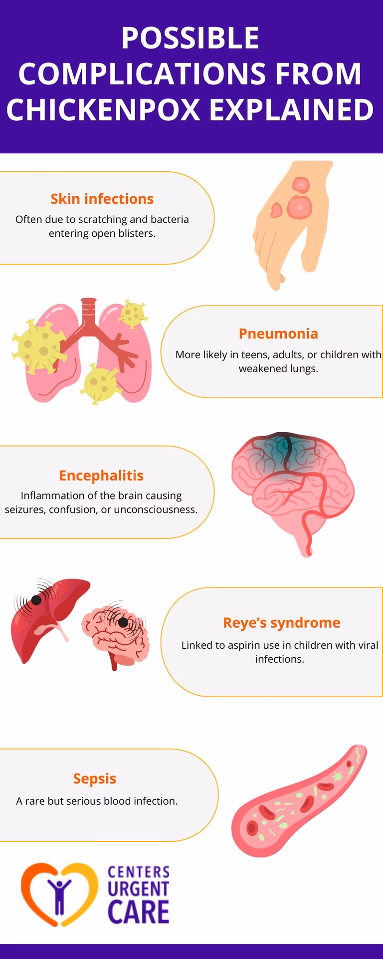 Does chickenpox cause haemorrhagic complications?