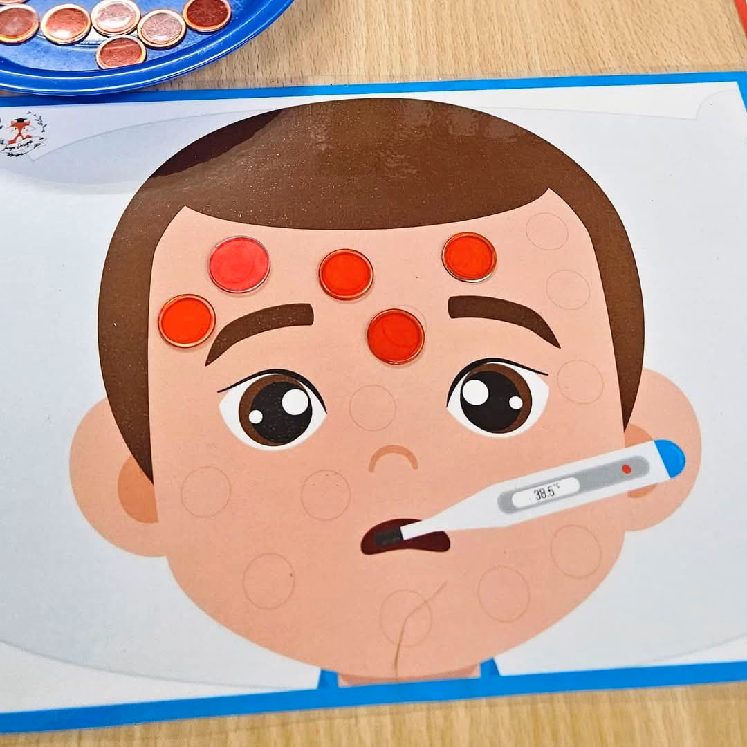 Is chicken pox free to play?