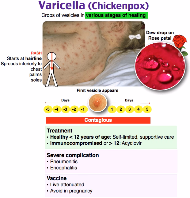 How long does it take for chickenpox to develop?