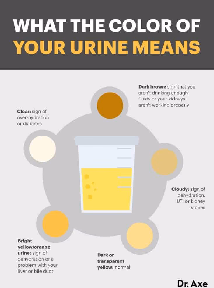 What does cloudy urine look like?