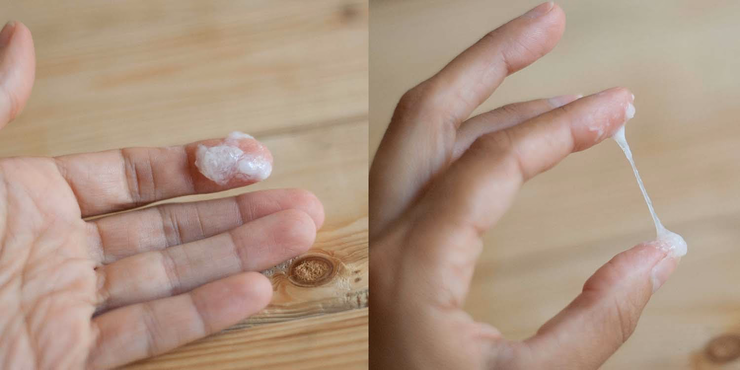 What does Chlamydia smell like?