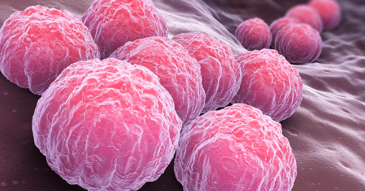 Como tratar a Chlamydia?