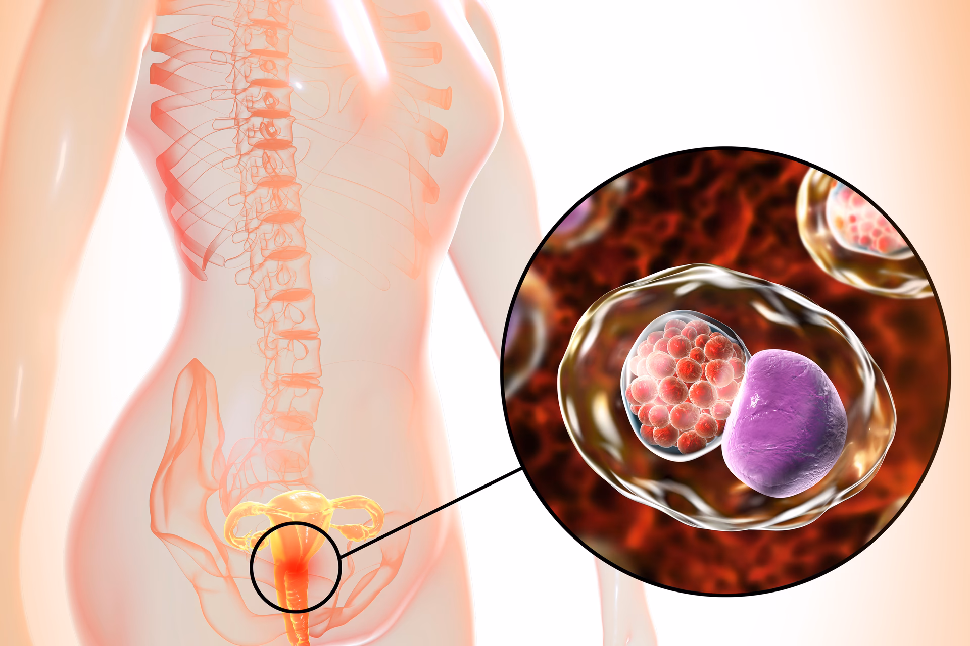O que é a Chlamydia trachomatis?