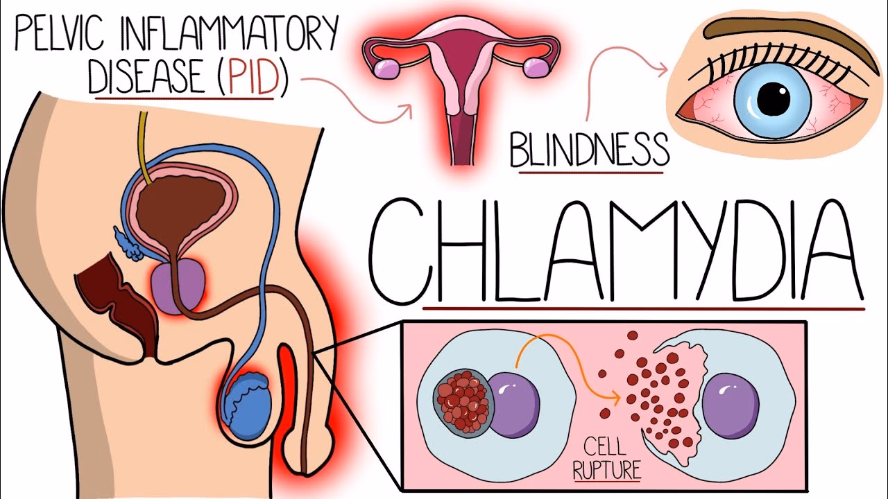 What does Chlamydia mean?