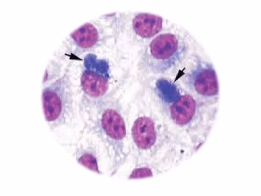 Can Giemsa stain Yersinia pestis?