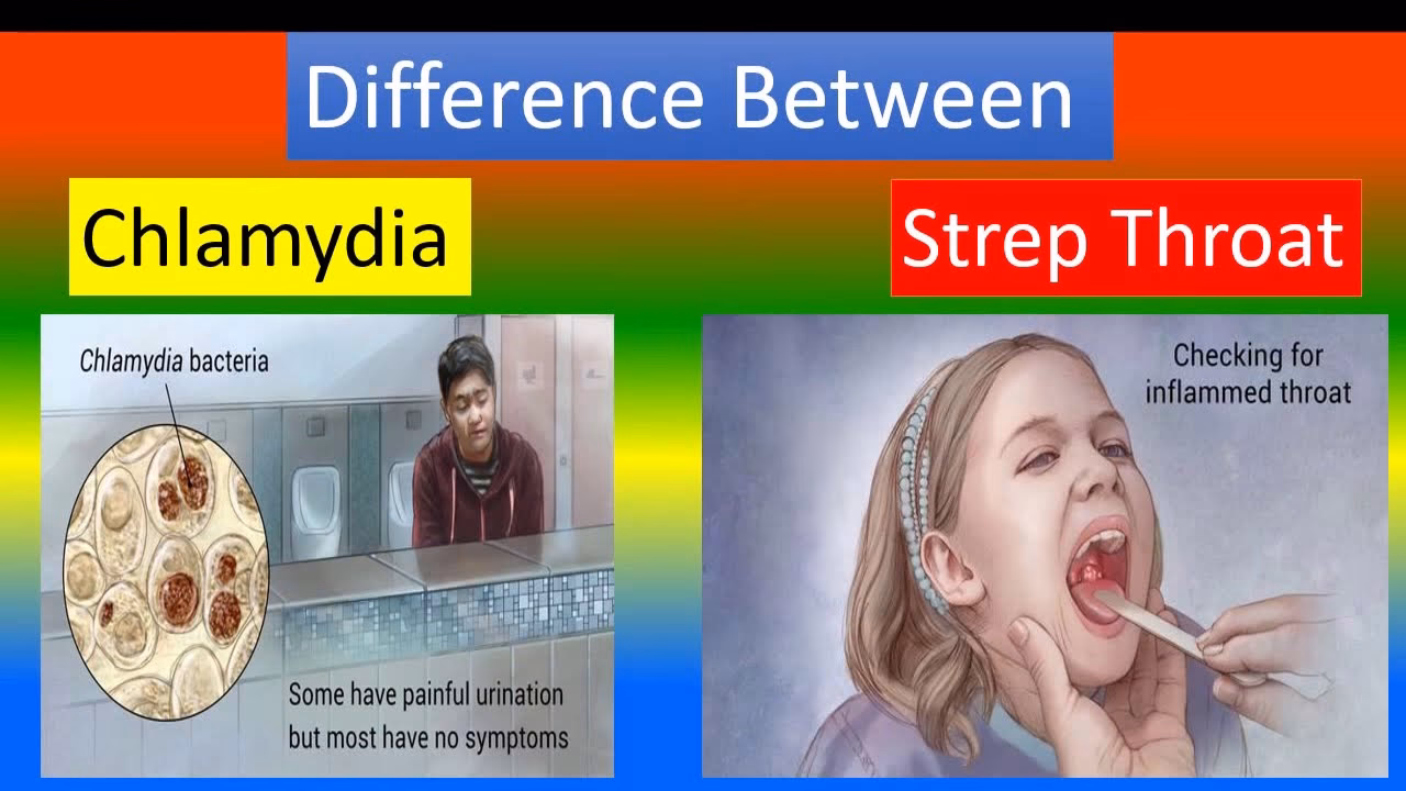 What are the symptoms of chlamydia?