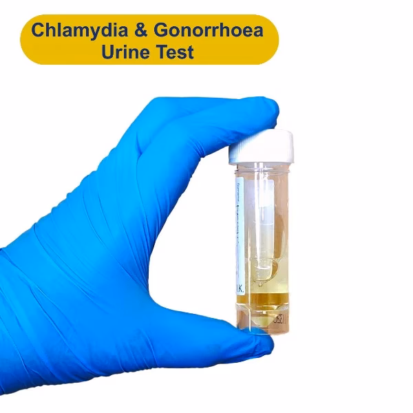 Are chlamydia and gonorrhea specific?