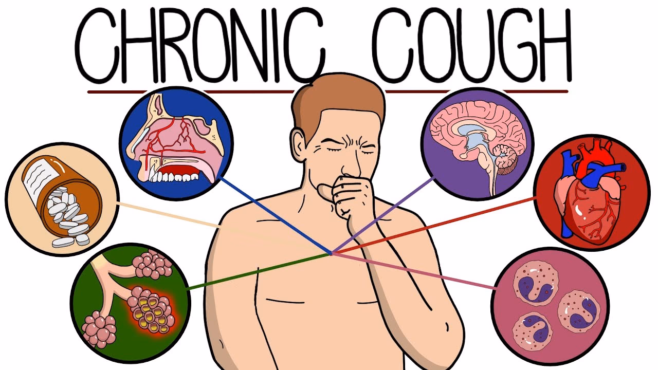 How is chronic cough treated?
